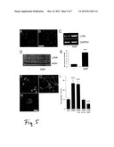 PROTEIN WITH PROMOTING EFFECTS FOR AXONAL GROWTH OF NEURONS OF CENTRAL     NERVOUS SYSTEM diagram and image