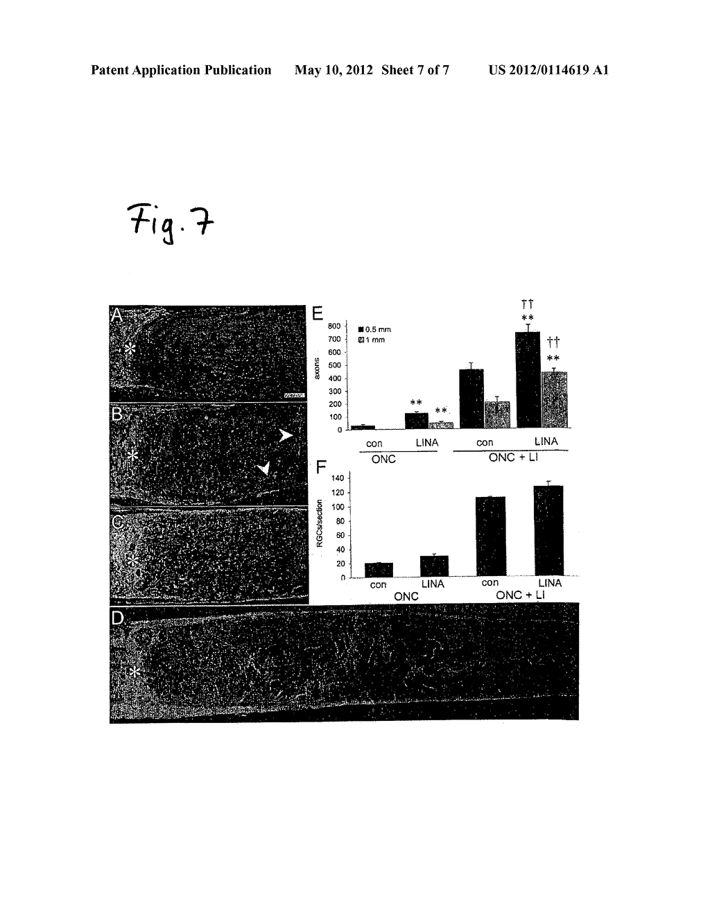 PROTEIN WITH PROMOTING EFFECTS FOR AXONAL GROWTH OF NEURONS OF CENTRAL     NERVOUS SYSTEM - diagram, schematic, and image 08