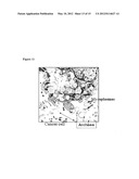 DIAGNOSIS, PREVENTION AND TREATMENT OF DISORDERS CHARACTERIZED BY     UNDESIRABLE CELL PROLIFERATION diagram and image