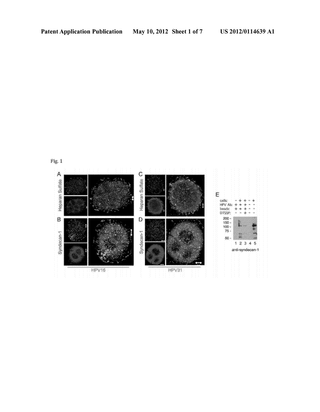 COMPOSITIONS AND METHODS FOR INHIBITING VIRAL AND/OR BACTERIAL INFECTIONS - diagram, schematic, and image 02