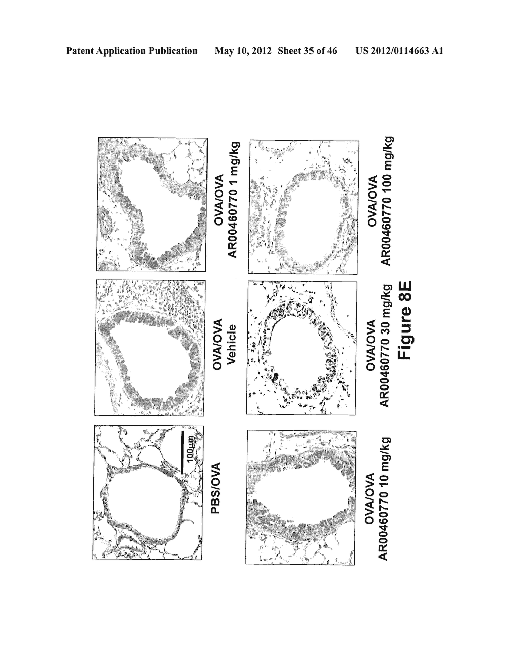 METHODS TO TREAT ALLERGIC CONDITIONS - diagram, schematic, and image 36