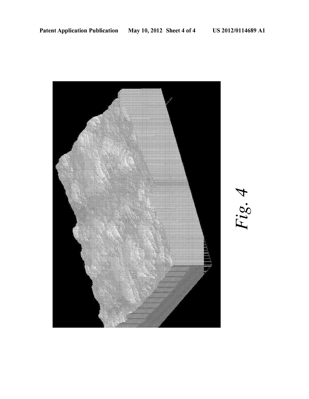 NICOTINAMIDE COMPOSITIONS FOR TREATMENT OF SKIN DISEASES AND DISORDERS - diagram, schematic, and image 05