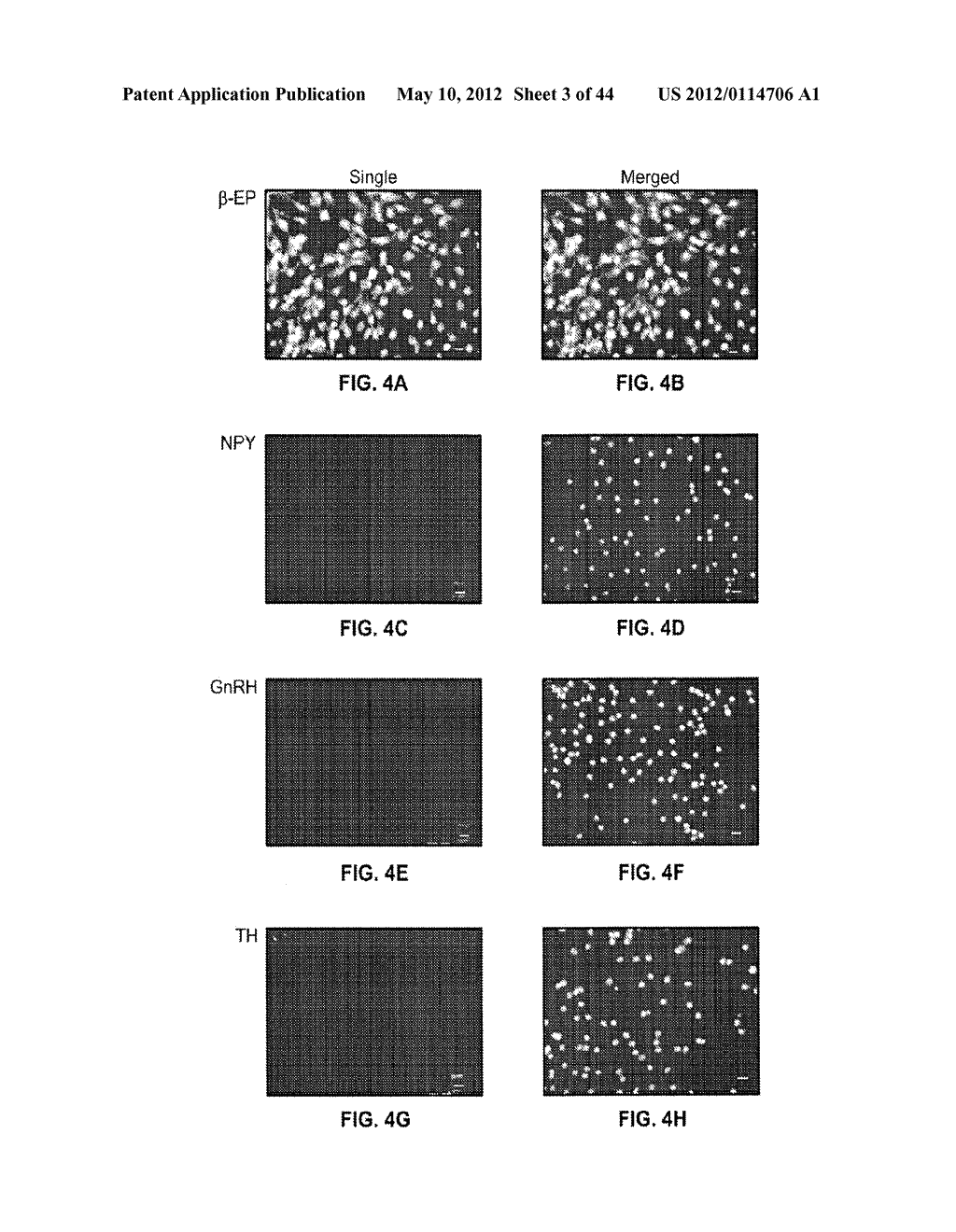 Endorphin Therapy Compositions and Methods of Use Thereof - diagram, schematic, and image 04