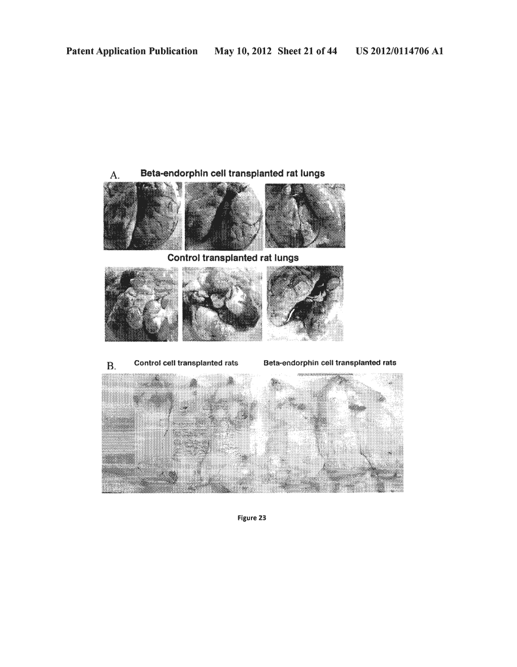 Endorphin Therapy Compositions and Methods of Use Thereof - diagram, schematic, and image 22