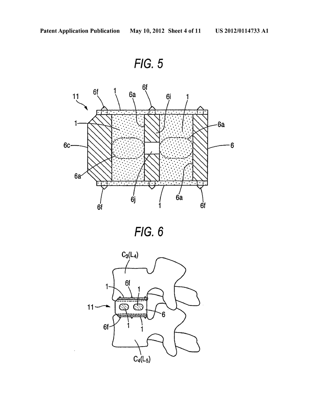 IMPLANT MATERIAL AND PRODUCTION METHOD THEREOF - diagram, schematic, and image 05