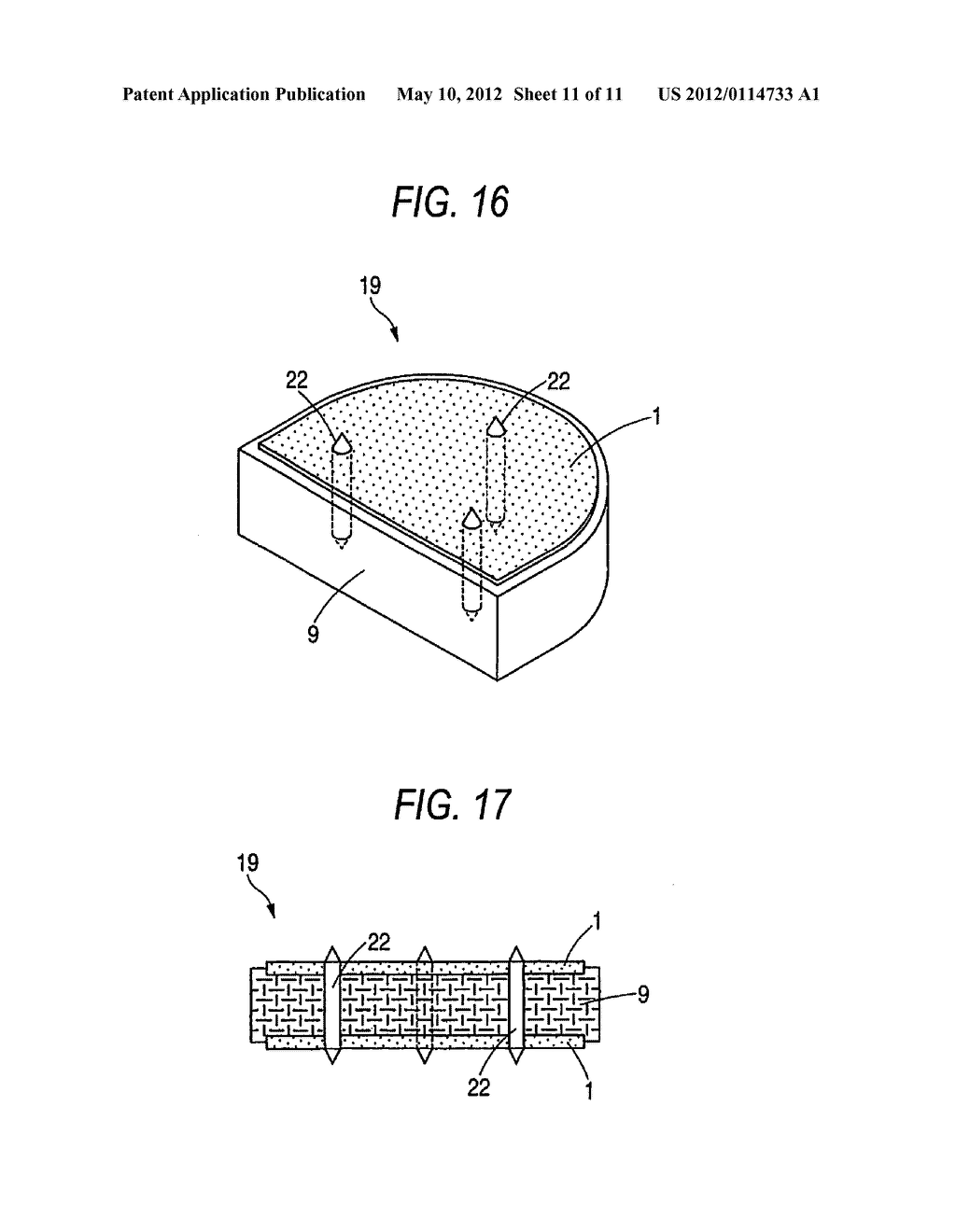 IMPLANT MATERIAL AND PRODUCTION METHOD THEREOF - diagram, schematic, and image 12