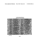 ELECTROPHORETIC DEPOSITION OF ADSORBENT MEDIA diagram and image