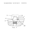 GINGIVA FORMER AND METHOD FOR PRODUCING A DESIGN OF A GINGIVA FORMER diagram and image