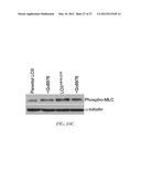 METHOD FOR DETECTING INVASIVE MICROVESCLES DERIVED FROM TUMOR CELLS diagram and image