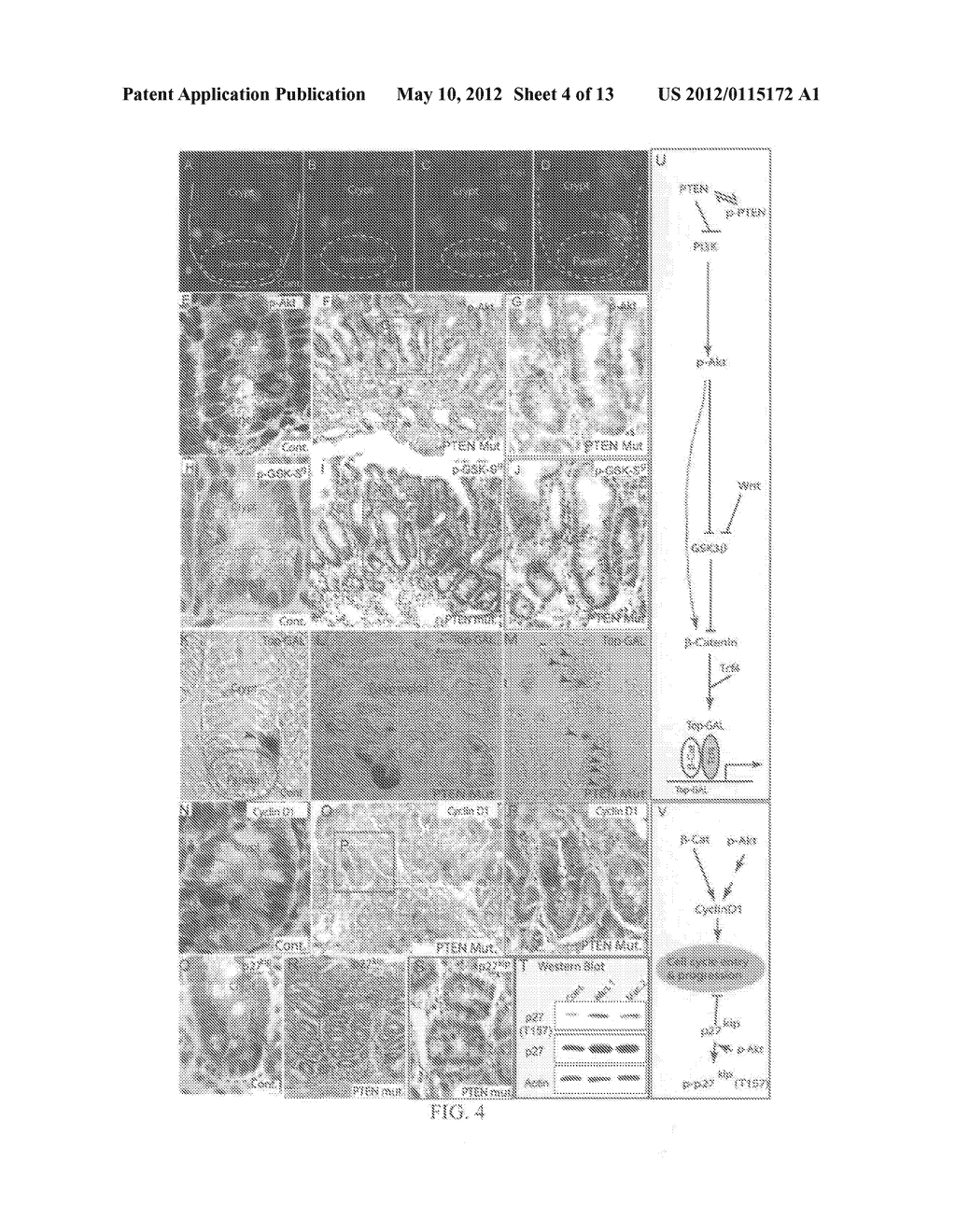 PTEN/AKT METHODS AND COMPOSITIONS RELATING TO BMP - diagram, schematic, and image 05