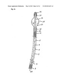  DEVICE FOR PREVENTING INCONTINENCE diagram and image