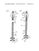  DEVICE FOR PREVENTING INCONTINENCE diagram and image