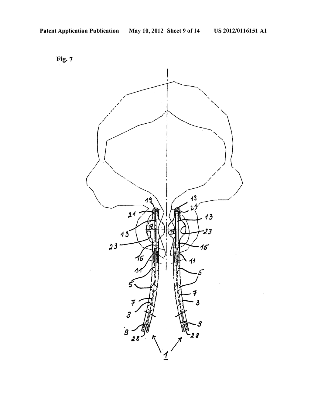  DEVICE FOR PREVENTING INCONTINENCE - diagram, schematic, and image 10