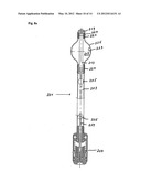  DEVICE FOR PREVENTING INCONTINENCE diagram and image