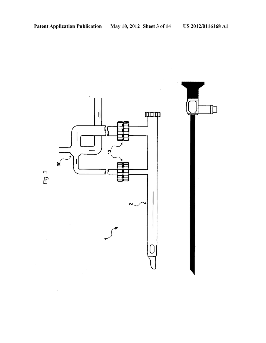 Method and device for flushing during endoscopic surgery - diagram, schematic, and image 04