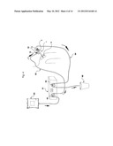 Method and device for flushing during endoscopic surgery diagram and image