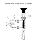 Method and device for flushing during endoscopic surgery diagram and image