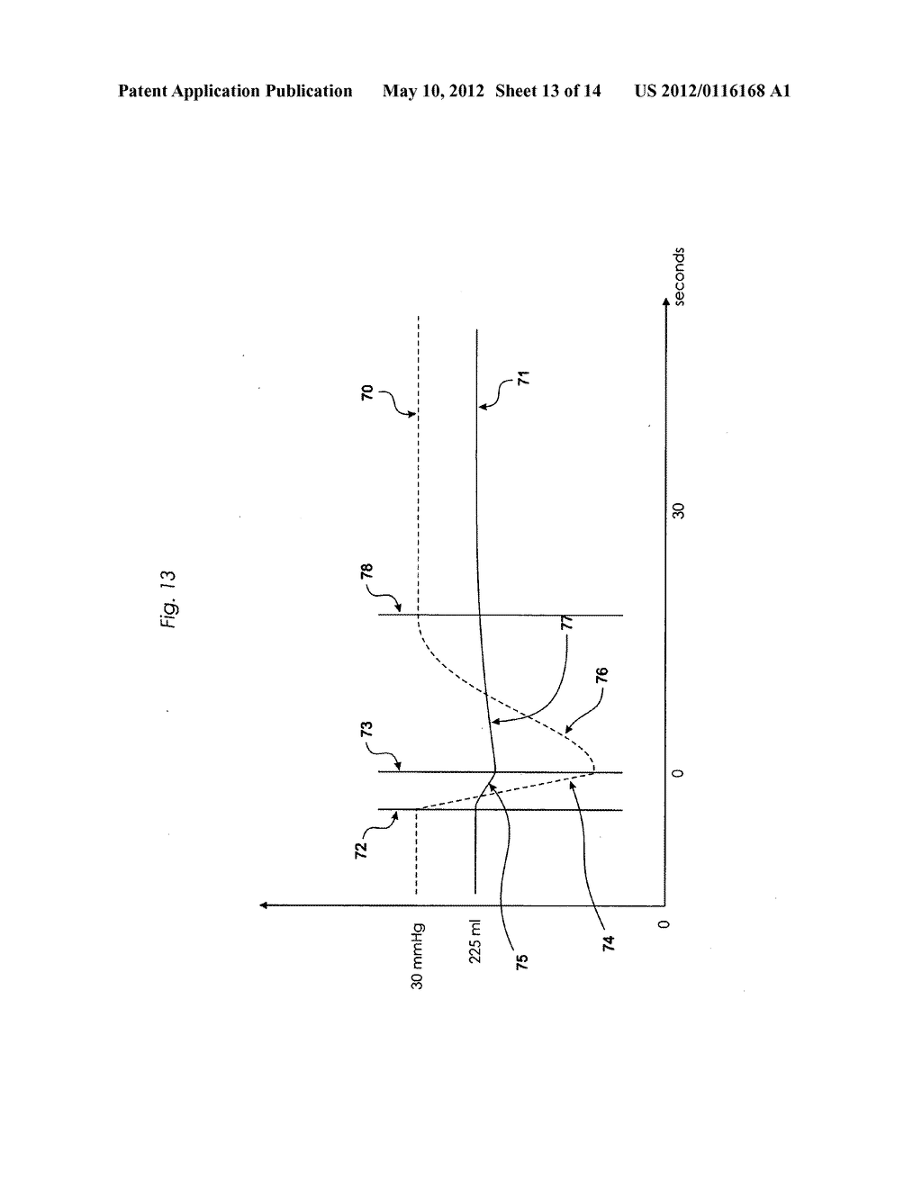 Method and device for flushing during endoscopic surgery - diagram, schematic, and image 14