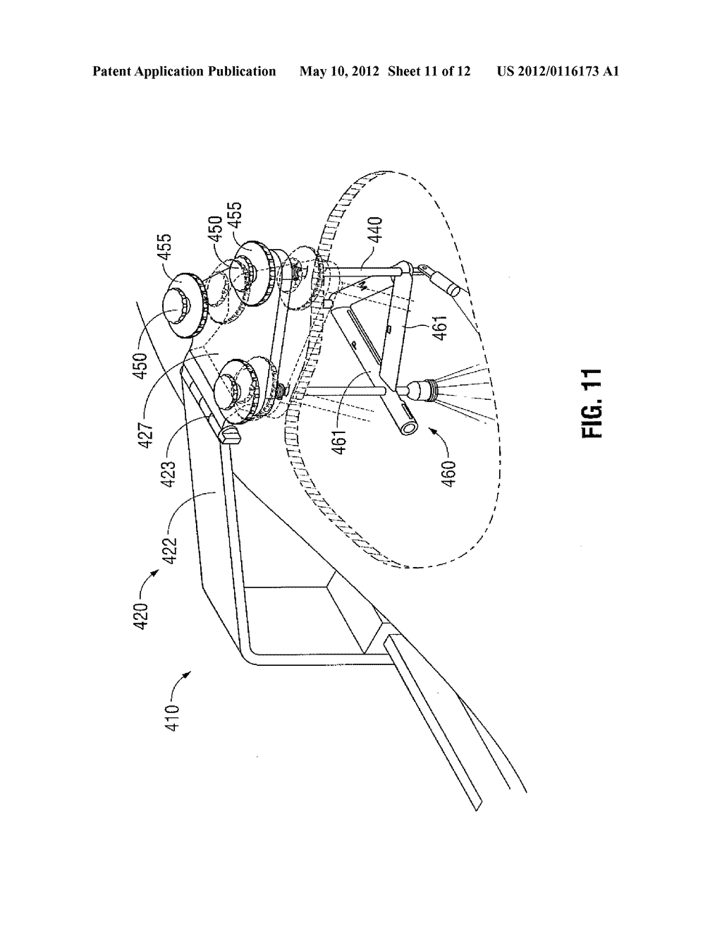 SUSPENSION SYSTEM FOR MINIMALLY INVASIVE SURGERY - diagram, schematic, and image 12