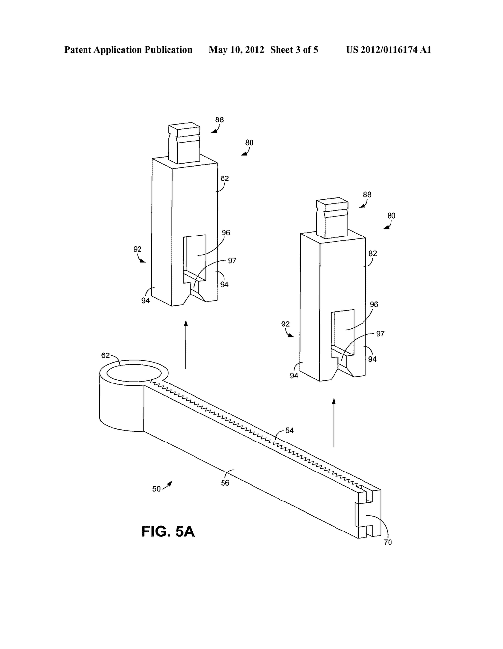 APPARATUSES AND METHODS FOR SUPPORTING AN UMBILICUS - diagram, schematic, and image 04