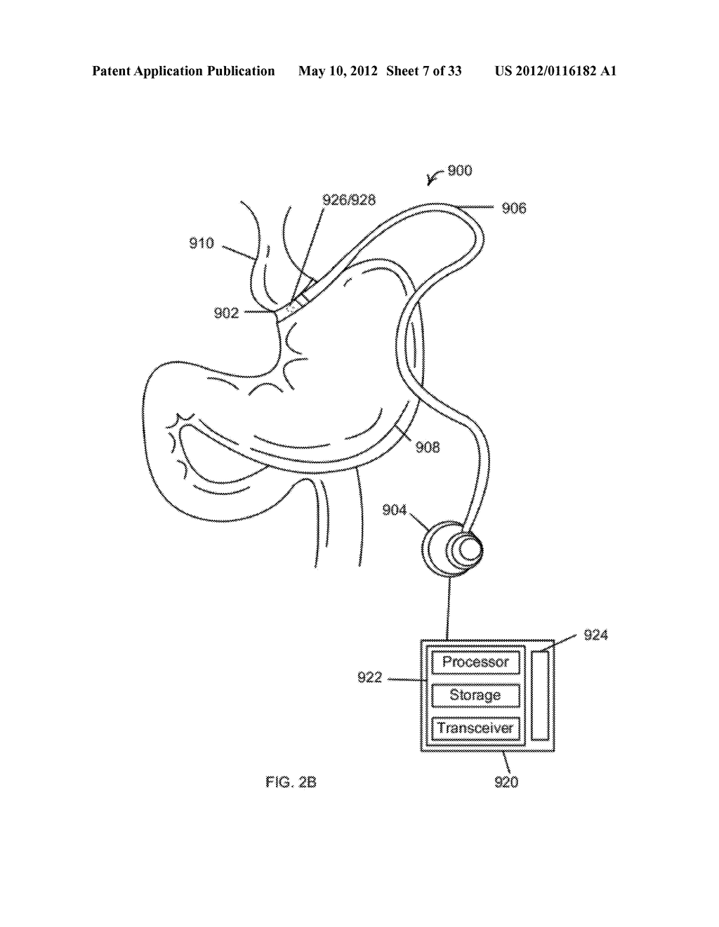 Feedback Systems and Methods to Enhance Obstructive and Other Obesity     Treatments, Optionally Using Multiple Sensors - diagram, schematic, and image 08