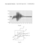 ELECTRO-PHYSIOLOGICAL MEASUREMENT WITH REDUCED MOTION ARTIFACTS diagram and image