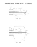 ORIENTATION DETERMINATION OF A MEDICAL DEVICE WITHIN A PATIENT diagram and image