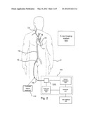 Multimodal Catheter System and Method for Intravascular Analysis diagram and image