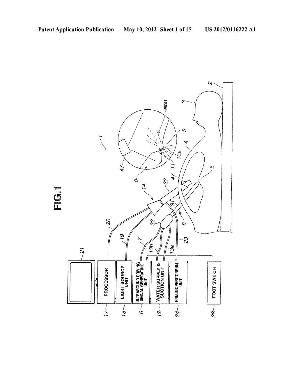 ULTRASOUND TREATMENT SYSTEM AND METHOD OF ACTUATING THE ULTRASOUND     TREATMENT SYSTEM - diagram, schematic, and image 02