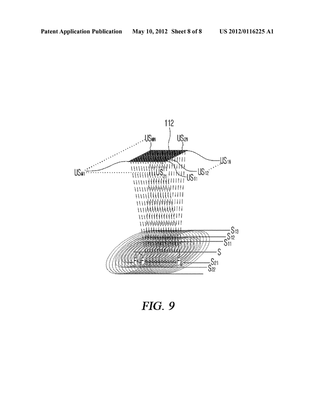 METHOD FOR GENERATING TRANSVERSE ELASTIC WAVES, AND METHOD AND APPARATUS     FOR ACQUIRING IMAGES USING TRANSVERSE ELASTIC WAVES - diagram, schematic, and image 09