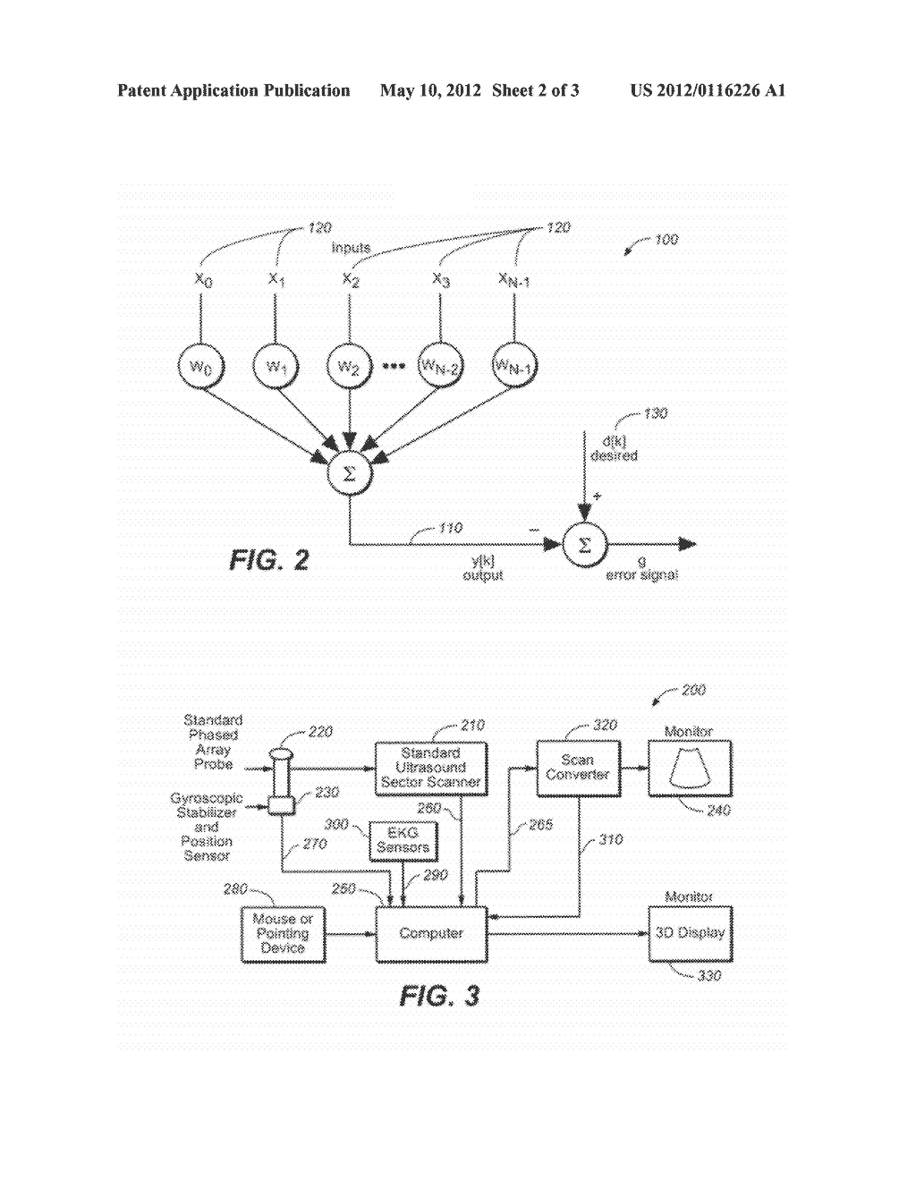 Method and Apparatus to Visualize the Coronary Arteries Using  Ultrasound - diagram, schematic, and image 03