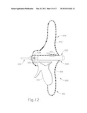 CAM DRIVEN COUPLING BETWEEN ULTRASONIC TRANSDUCER AND WAVEGUIDE IN     SURGICAL INSTRUMENT diagram and image