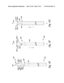 OCCLUSION APPARATUS diagram and image