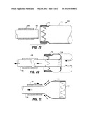 INTESTINAL SLEEVES AND ASSOCIATED DEPLOYMENT SYSTEMS AND METHODS diagram and image