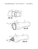 INTESTINAL SLEEVES AND ASSOCIATED DEPLOYMENT SYSTEMS AND METHODS diagram and image