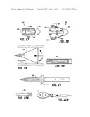 INTESTINAL SLEEVES AND ASSOCIATED DEPLOYMENT SYSTEMS AND METHODS diagram and image