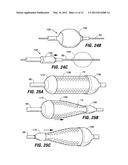 INTESTINAL SLEEVES AND ASSOCIATED DEPLOYMENT SYSTEMS AND METHODS diagram and image