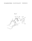 IMPLANTABLE MEDICAL DEVICE FOR LUBRICATING AN ARTIFICIAL CONTACTING     SURFACE AND METHOD OF IMPLANTING THE DEVICE diagram and image