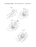 IMPLANTABLE MEDICAL DEVICE FOR LUBRICATING AN ARTIFICIAL CONTACTING     SURFACE AND METHOD OF IMPLANTING THE DEVICE diagram and image