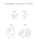 IMPLANTABLE MEDICAL DEVICE FOR LUBRICATING AN ARTIFICIAL CONTACTING     SURFACE AND METHOD OF IMPLANTING THE DEVICE diagram and image