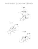 IMPLANTABLE MEDICAL DEVICE FOR LUBRICATING AN ARTIFICIAL CONTACTING     SURFACE AND METHOD OF IMPLANTING THE DEVICE diagram and image