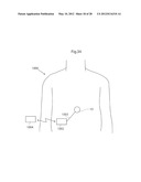 IMPLANTABLE MEDICAL DEVICE FOR LUBRICATING AN ARTIFICIAL CONTACTING     SURFACE AND METHOD OF IMPLANTING THE DEVICE diagram and image