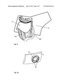 METHOD FOR IMPLANTING AN ACCESS PORT diagram and image