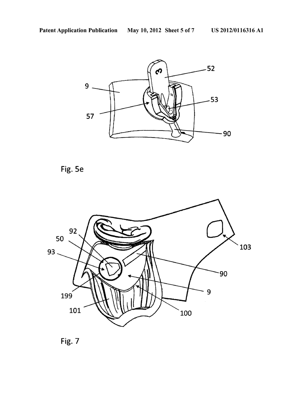 METHOD FOR IMPLANTING AN ACCESS PORT - diagram, schematic, and image 06