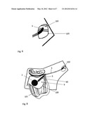 METHOD FOR IMPLANTING AN ACCESS PORT diagram and image