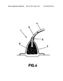 Sealing Device For Vacuum Pressure Therapy diagram and image