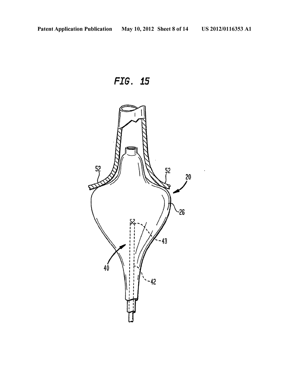 COAXIAL CATHETER INSTRUMENTS FOR ABLATION WITH RADIANT ENERGY - diagram, schematic, and image 09