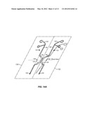 SINGLE PORT LAPAROSCOPIC ACCESS WITH LATERALLY SPACED VIRTUAL INSERTION     POINTS diagram and image