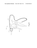 SELECTIVE ACTIVATION OF ELECTRONIC COMPONENTS IN MEDICAL DEVICE diagram and image