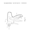 SELECTIVE ACTIVATION OF ELECTRONIC COMPONENTS IN MEDICAL DEVICE diagram and image